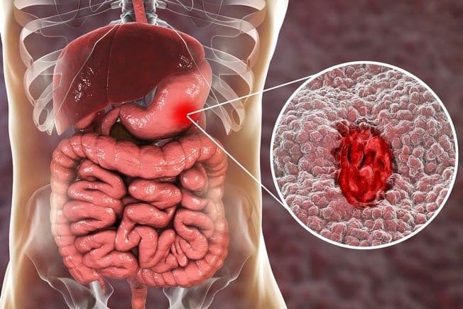Gastric Wellness
